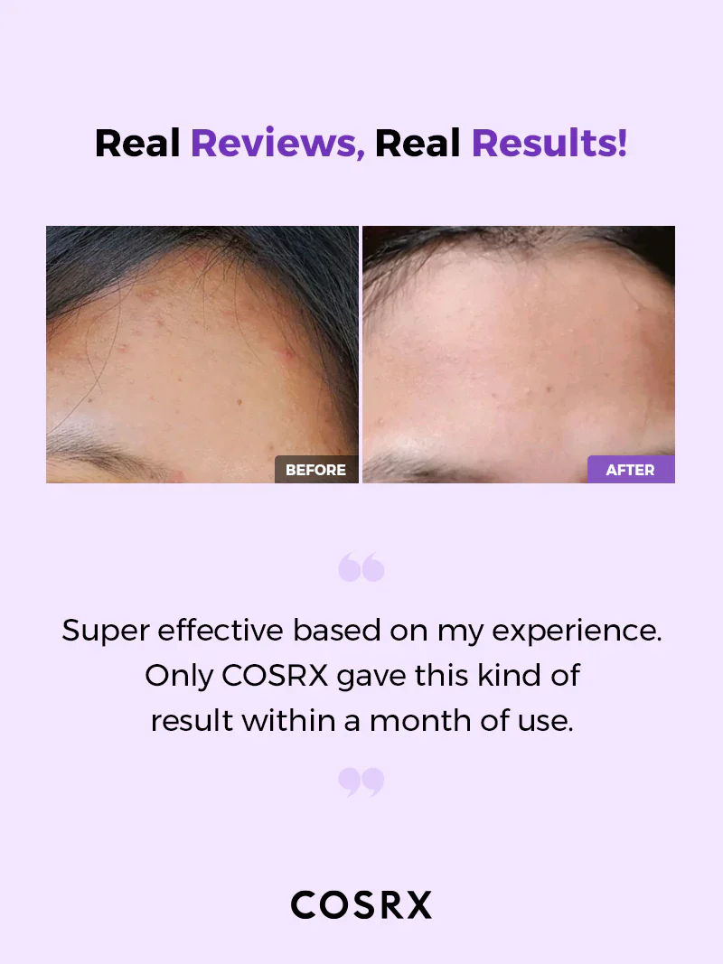 Cosrx AHA/BHA Clarifying Treatment Toner - Image 4