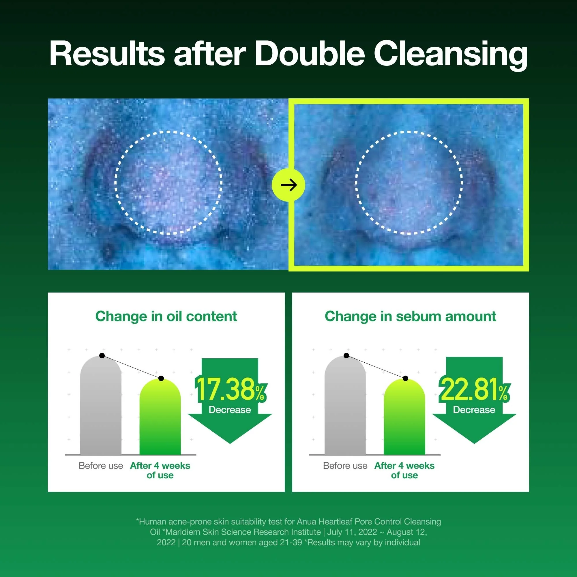 Anua X KDH Double Cleansing Duo Set - Image 5
