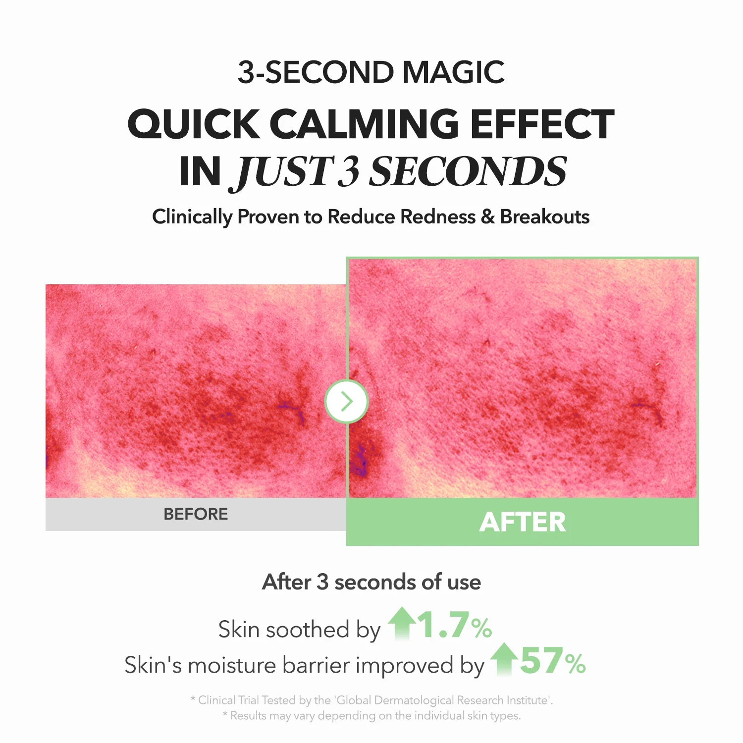 April Skin Ace Mugwort Centella Caling Serum 110g - Image 4