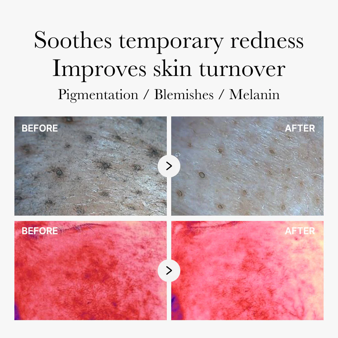 Medicube Red Succinic Acid Peeling Pad - Image 6