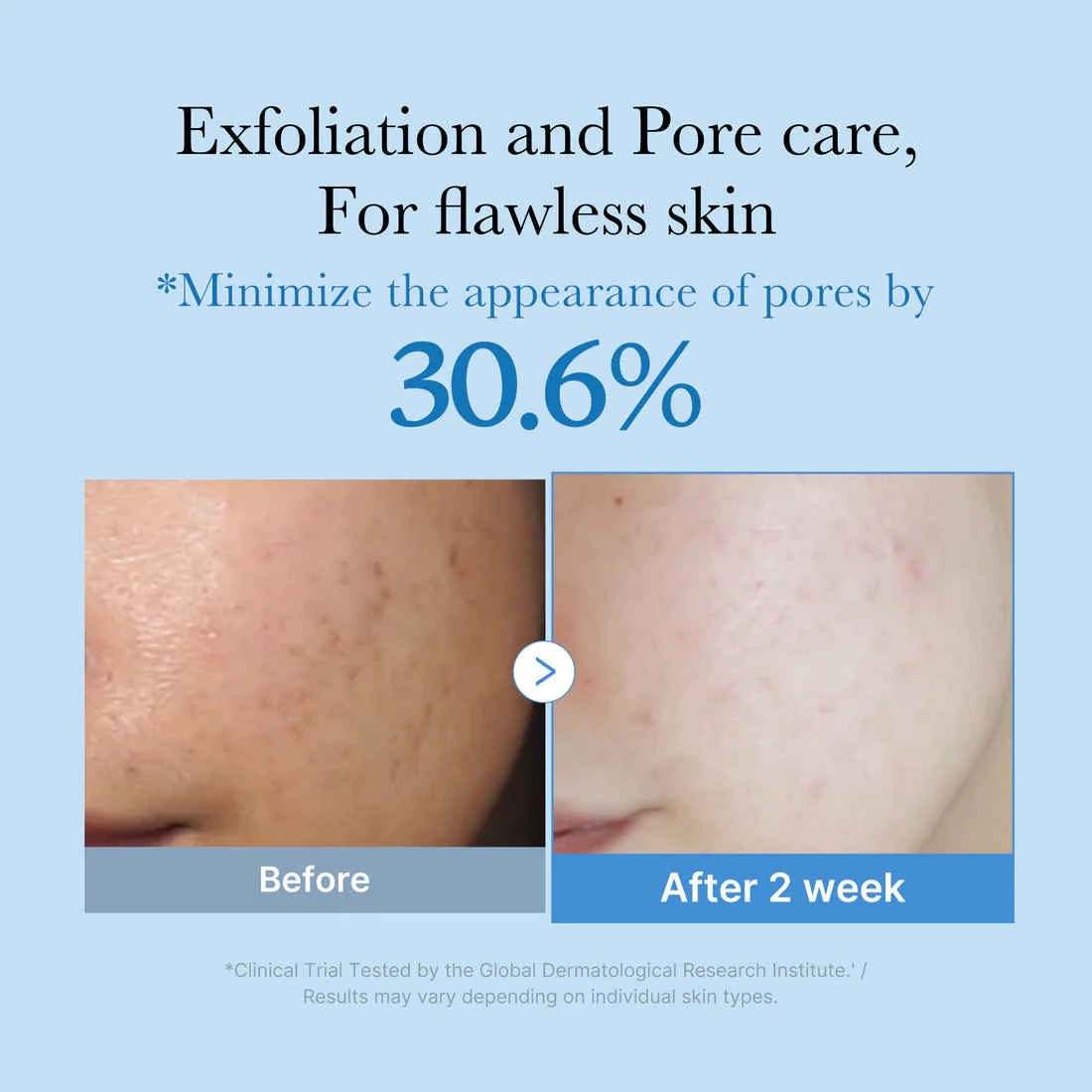 Medicube Zero Pore Toner 250ml - Image 4