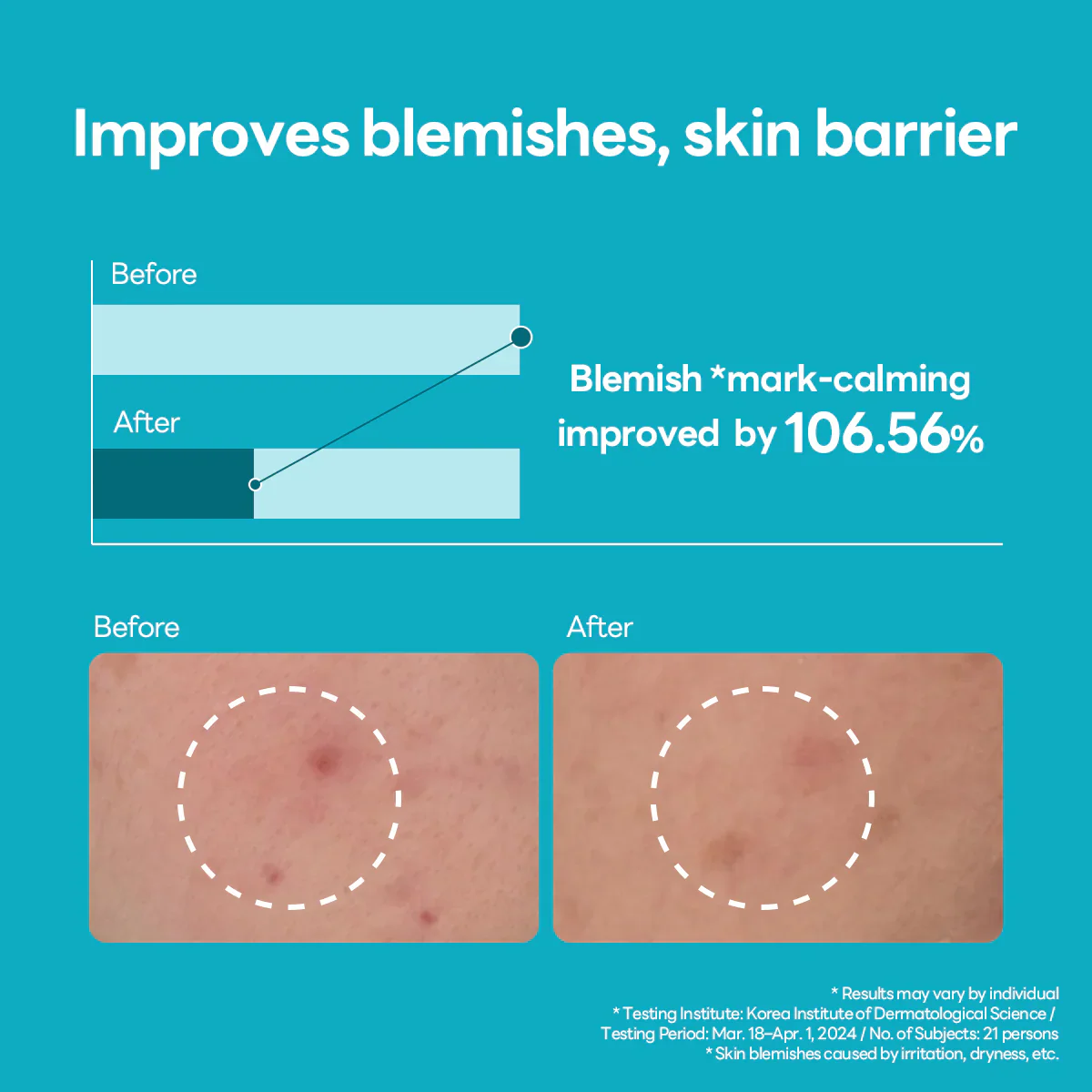 Mediheal Madecassoside Blemish Repair Serum 40ml - Image 5