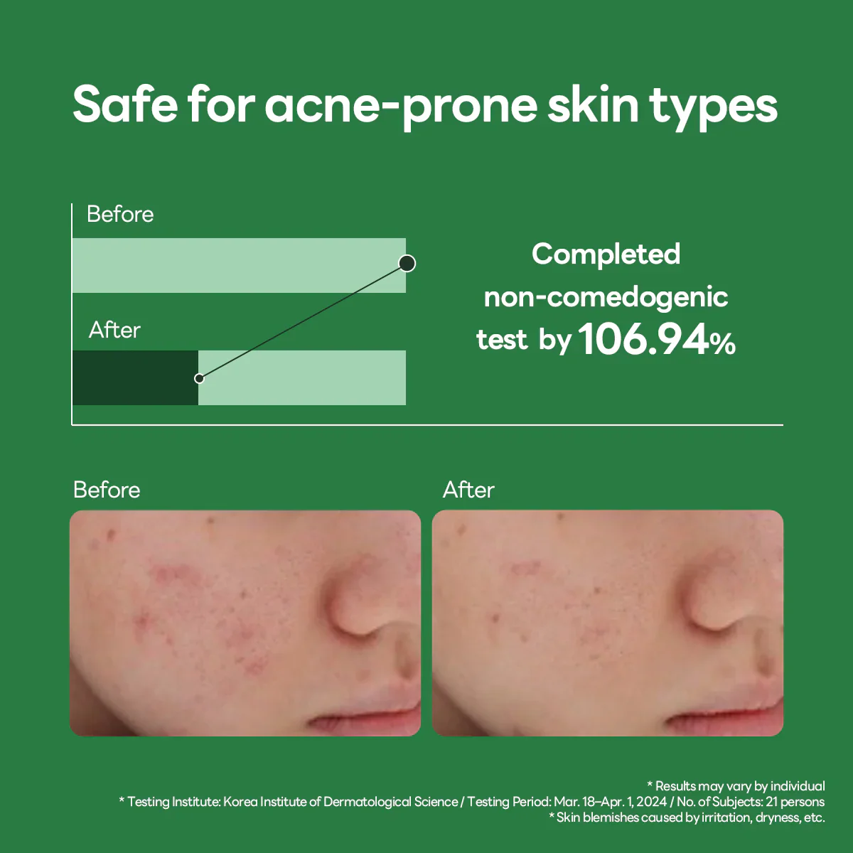 Mediheal Teatree Calming Hydra Serum 40ml - Image 4
