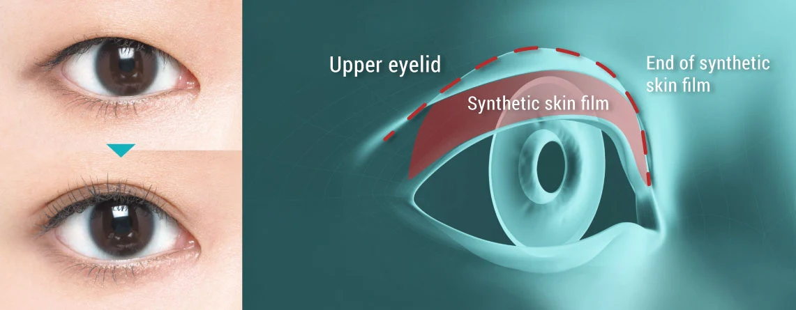 Dup Orishiki Eyelid Skin Film - Image 2