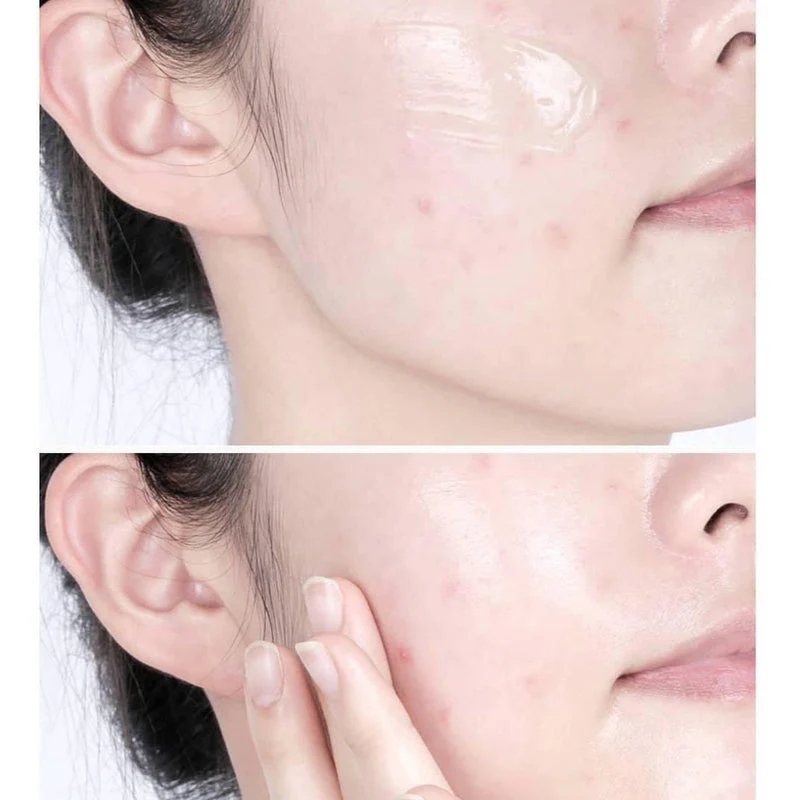 VT Cosmetics Cica Cream 50ml - Image 5